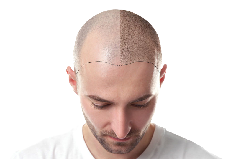 Bald Head PNG Background