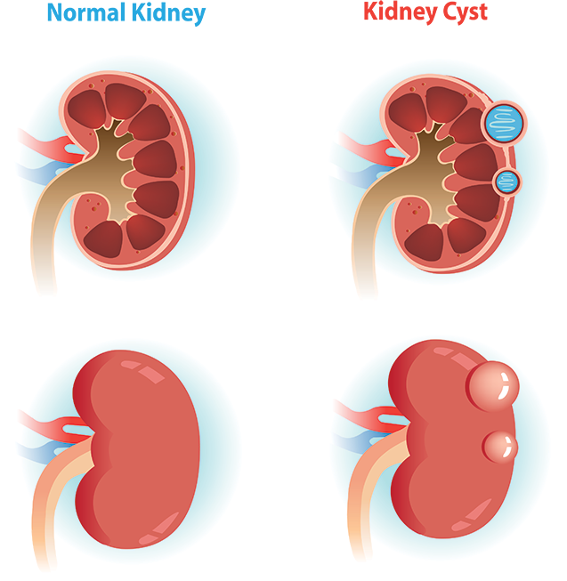 Kidney PNG Free Image