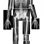 X ray png gambar gratis