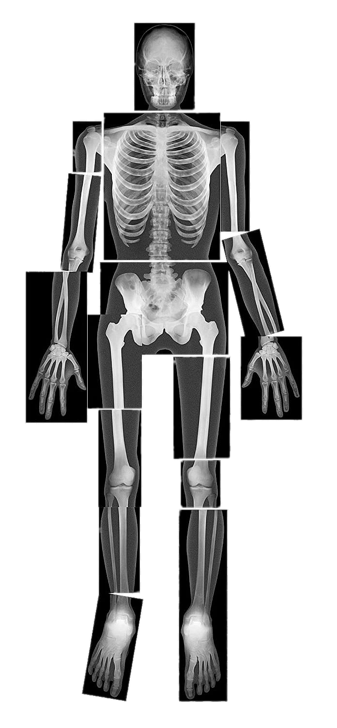X Ray PNG Free Image
