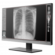 X Ray Png HD Immagine