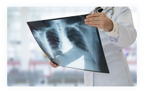 X Ray PNG High Quality Image