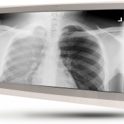 X Ray Png Immagine