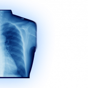 X RAY PNG FILE
