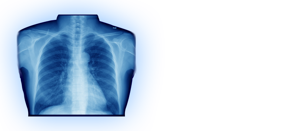 X Ray PNG Image File