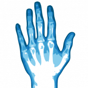 X ray png immagine hd