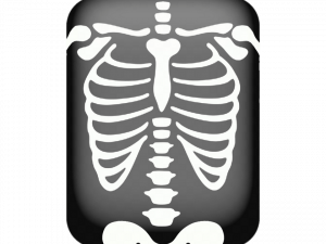 X Ray PNG Picture