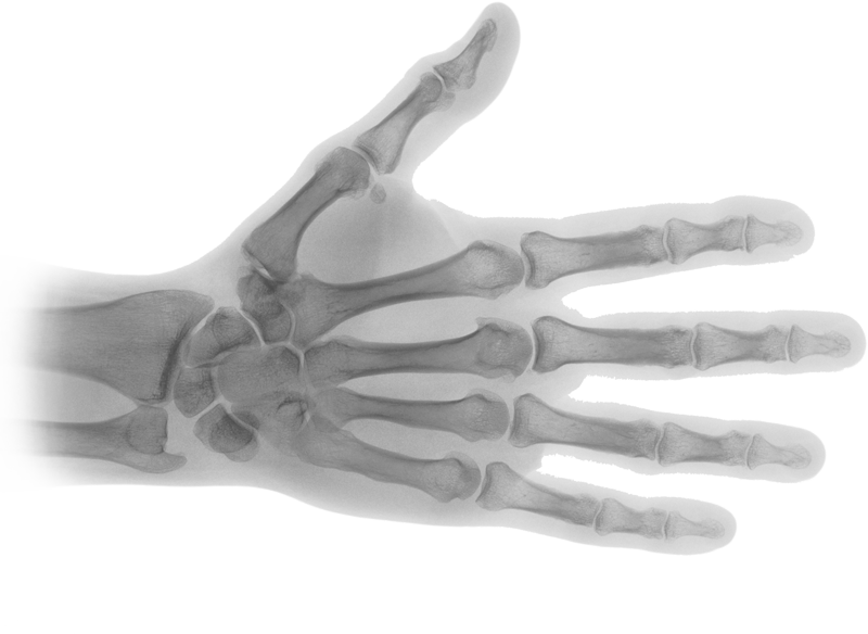 X Ray PNG Transparent HD Photo