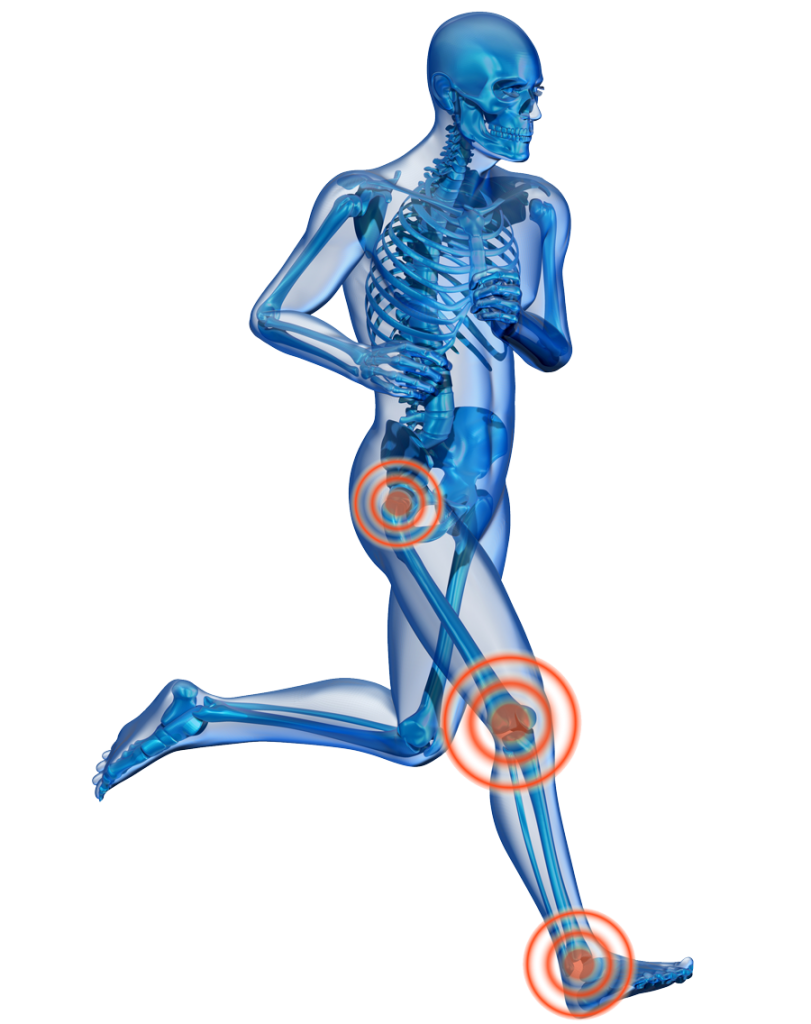 Joint Pain Relief PNG Clipart