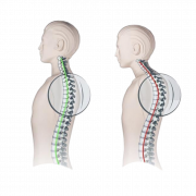 Neck Pain PNG Free Download